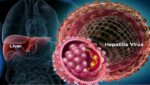 Hepatologist in Pune | Hepatologist Doctor in Pune – Dr. Ninad Deshmukh