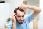 Is Finasteride an Effective Solution for Hair Loss?