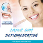 My Gums have a dark colored pigmentation…….what do I do?