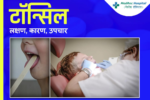 Tonsil Stones: Causes, Symptoms, And Treatment In Hindi