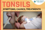 Tonsil Stones: Causes, Symptoms, and Treatment Options