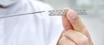 Lung Stent Market Size, Share | Global Industry Report