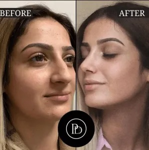 PRP Treatment Doctors in dubai