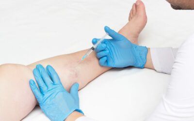 what is a varicose vein specialist called