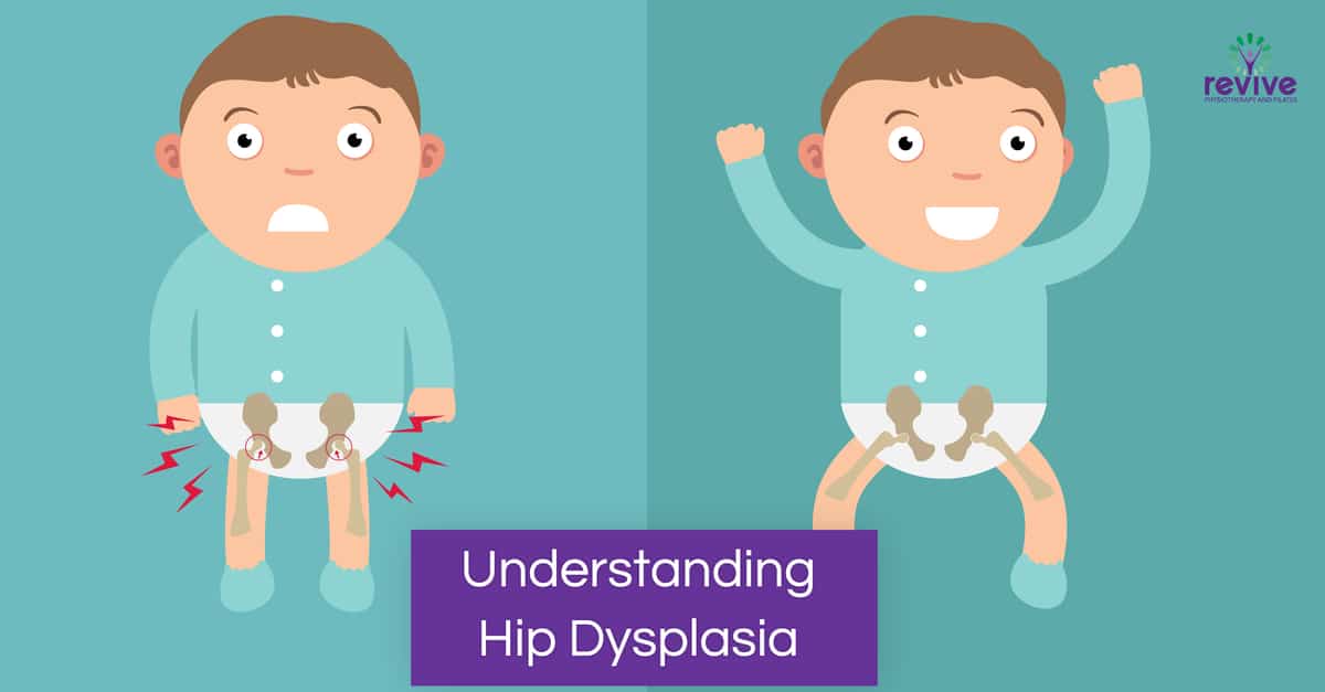 hip problems symptoms in children