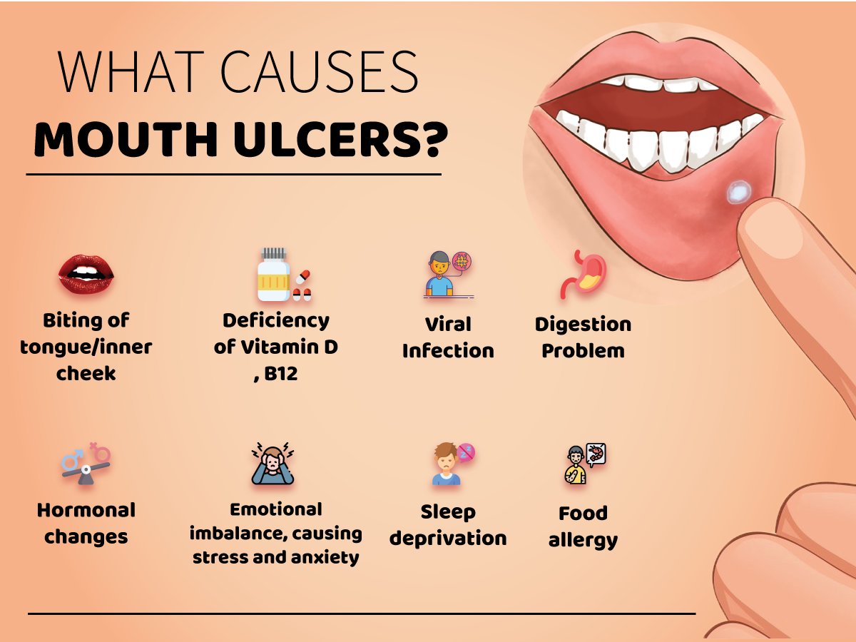 Mouth Ulcers