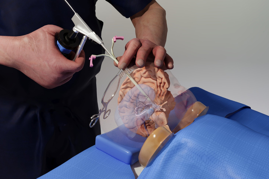 Brain Surgery