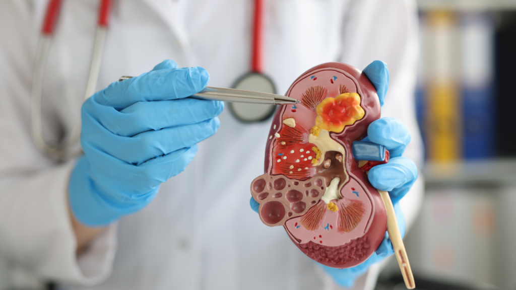 high creatinine treatment