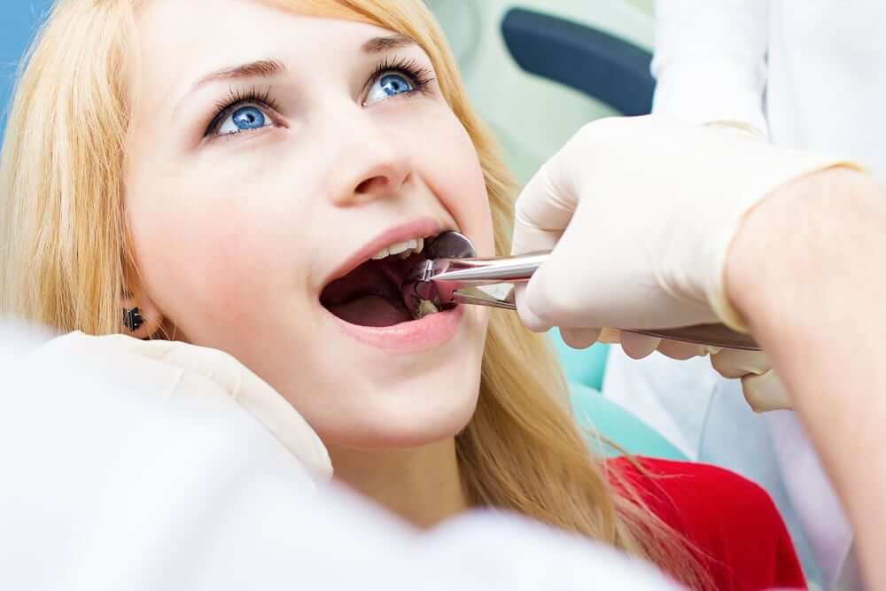 Tooth Extraction in Canberra