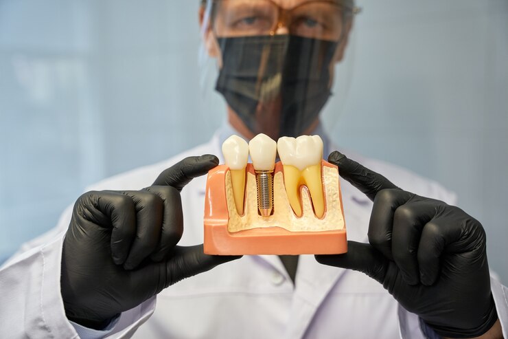 dental implant cost in chennai