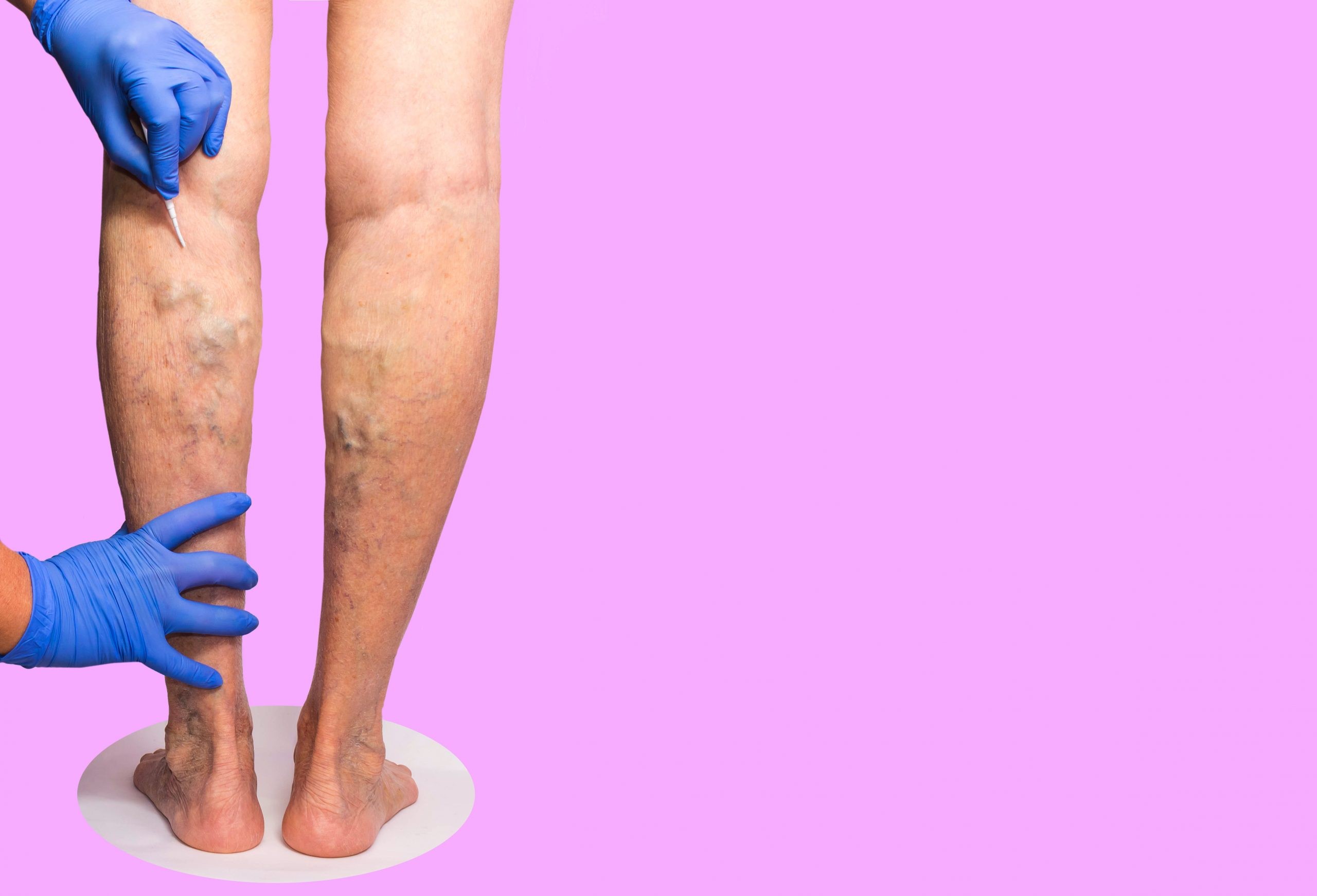 what do vein centers do